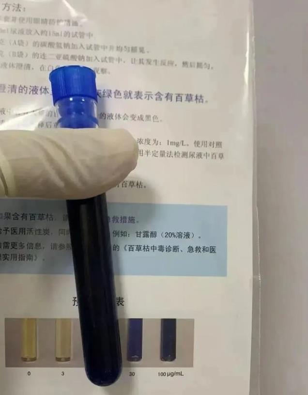 奇迹！男子喝下一大口百草枯 尿液全黑 医生吓坏，抢救28天后出院！
