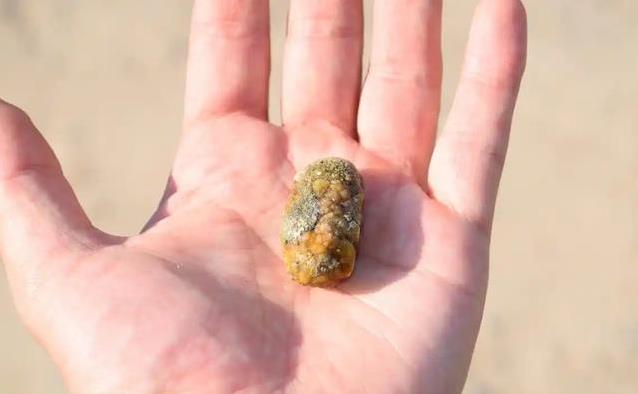大妈顿顿吃芹菜想清胆，医生却摇头，这3种菜吃多结石更糟？
