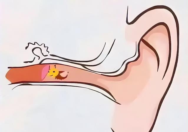 油耳朵让你嫌弃？医生揭秘：它比干耳朵强5大优势！