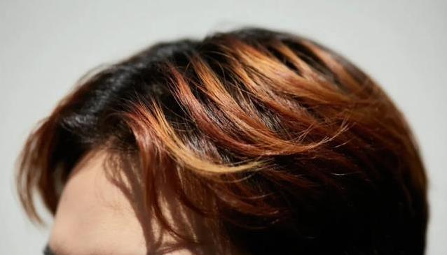 18岁女孩染红发肾病复发，医生怒斥染发剂，多少人还在频繁用？