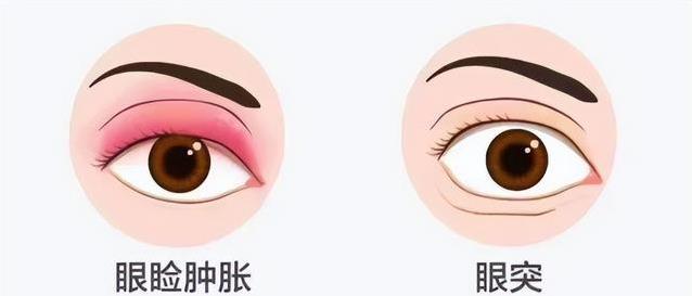 眼白发黄藏大病？5种异常信号，千万别不当回事！