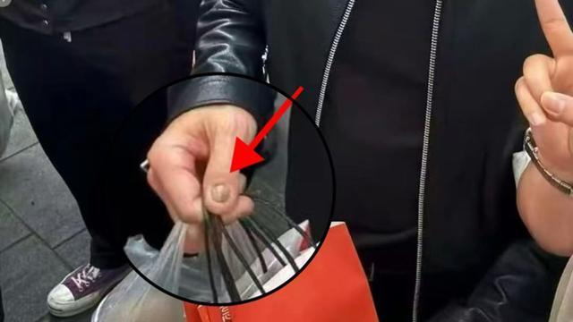黄仁勋指甲上热搜 医生：6种情况都可能