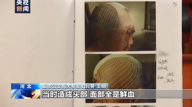 警方指出陈某志犯罪团伙手段残忍：U型锁击打头部