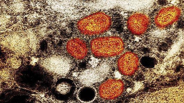 世卫组织：全球累计猴痘确诊病例超5万例 死亡16例