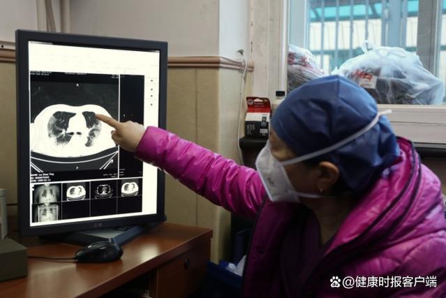 肺部CT需求暴增 检出率约10%-20% 专家：即使肺部出现炎症也并非都为危急重症