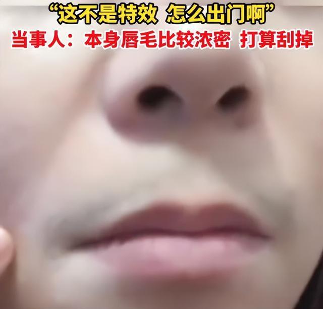 女生感染变男声：不但阳了还阳刚了，此前曾有女子阳后长出浓密胡子