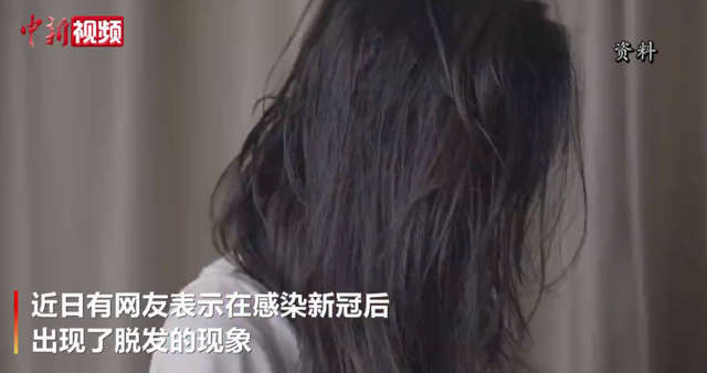 专家说感染新冠后脱发比较普遍，不需要特别去干预，2到3个月就会止住