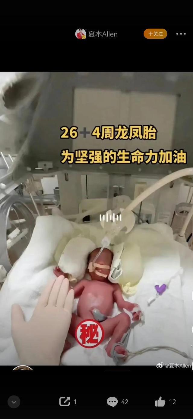 护士给0.9kg早产儿扎针：婴儿手臂只有护士手指粗，浑身紫红