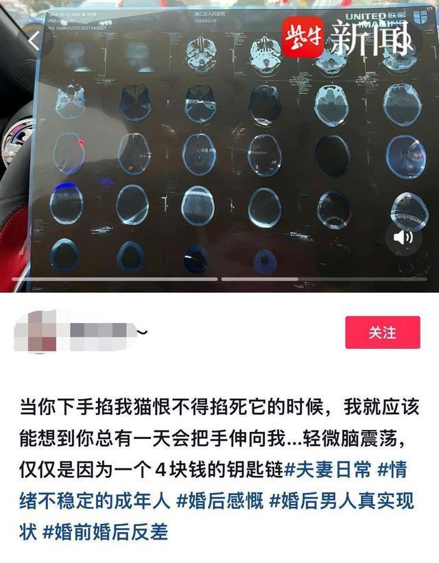 女子称领证次日被家暴 女子老公婚前就虐猫差点掐死它