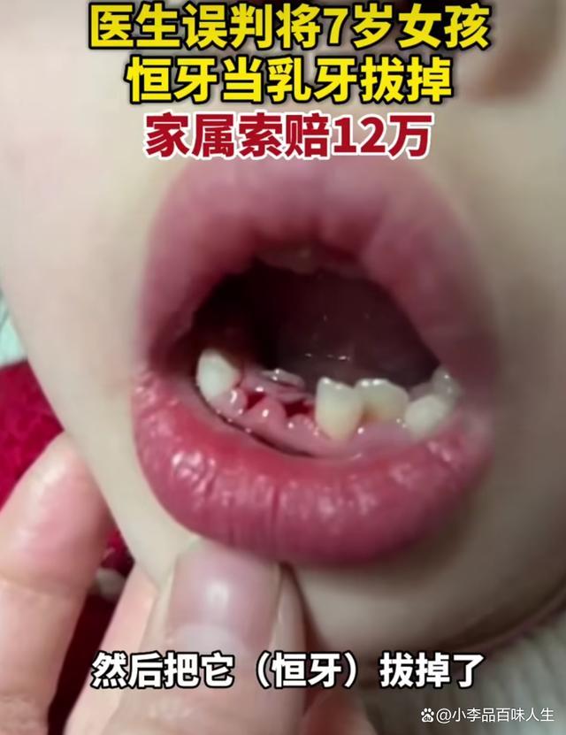 医生误将女孩恒牙拔掉，涉事诊所：判断失误了