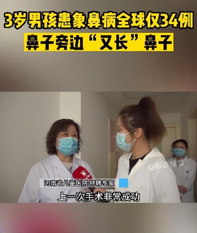 郑州一3岁男孩患象鼻病，全球仅34例且只在非洲国家发现