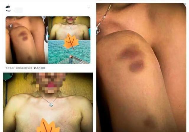 当地警方回应女生遭性侵 在马尔代夫被酒店管家强奸但无人被逮捕？