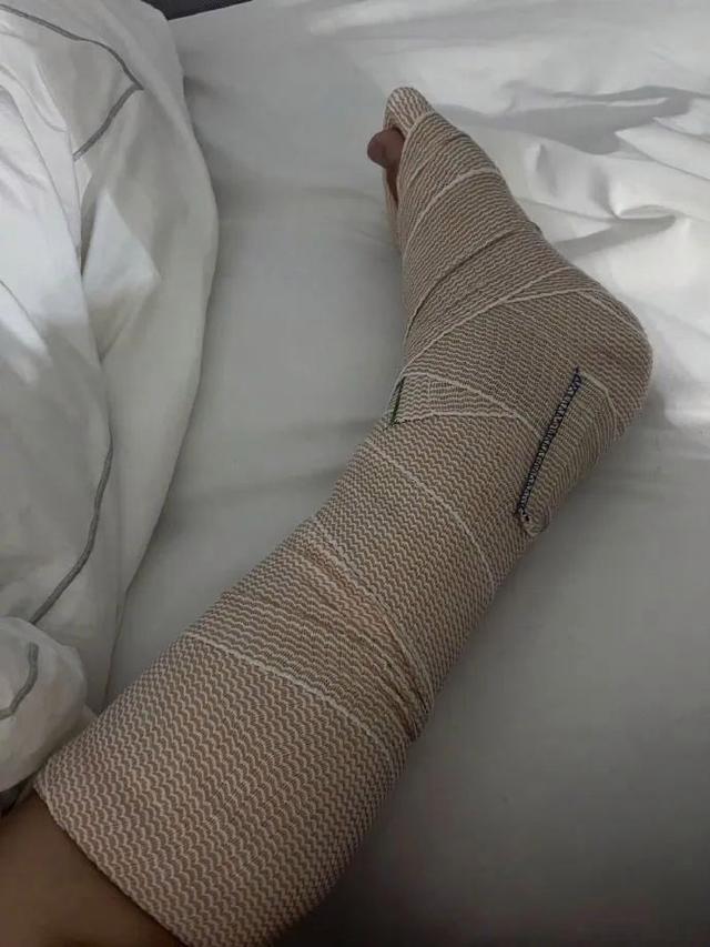 陈学冬自曝车祸中受伤，已做三次手术！