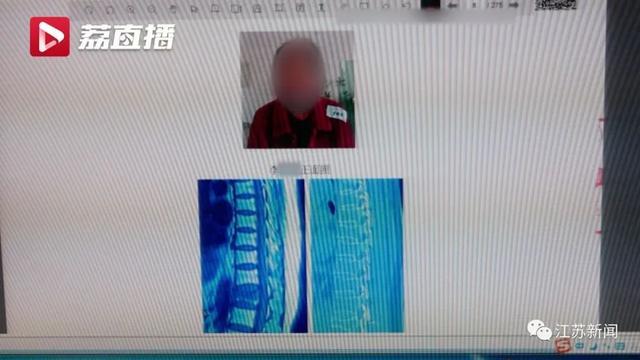 员工玩蛙跳摔成十级伤残，要求赔偿却遭拒！法院这样判