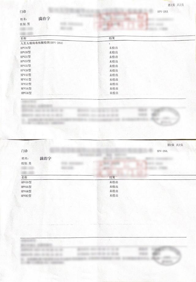 ​歌手满舒克被控恶意传播hpv,工作室回应,网友:把时间都打码了_新