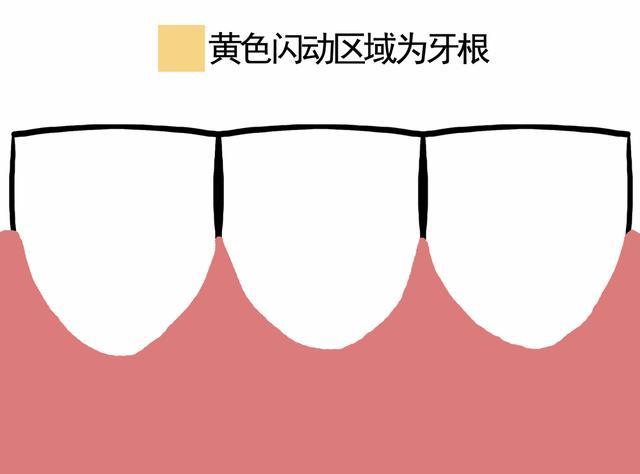 塞牙可能是你的牙在喊救命