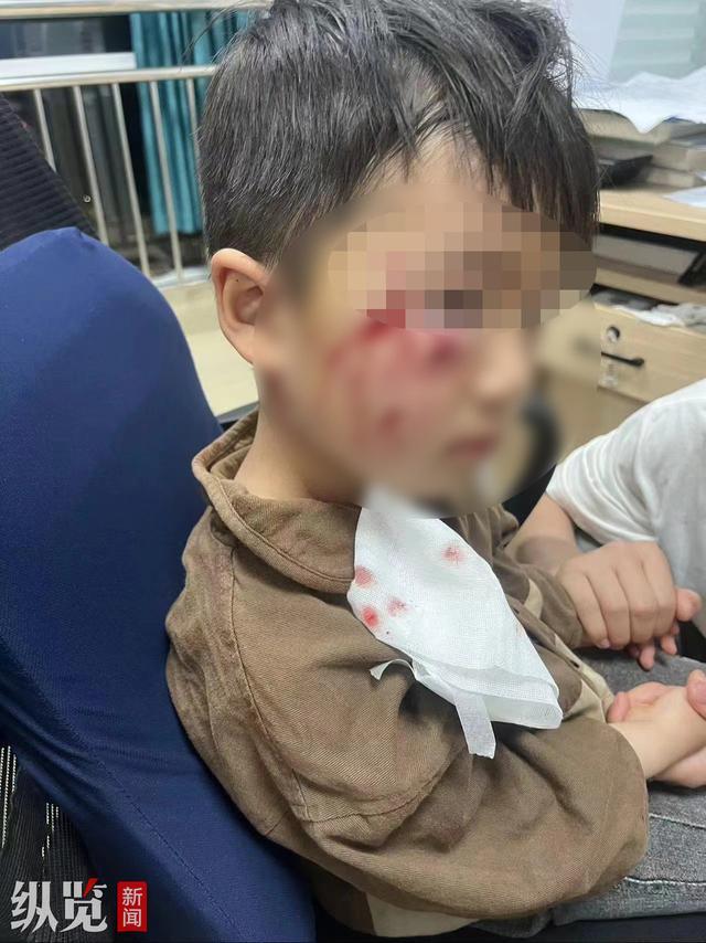 3岁男童被恶犬咬伤离世 母亲发声：还没找到狗主人