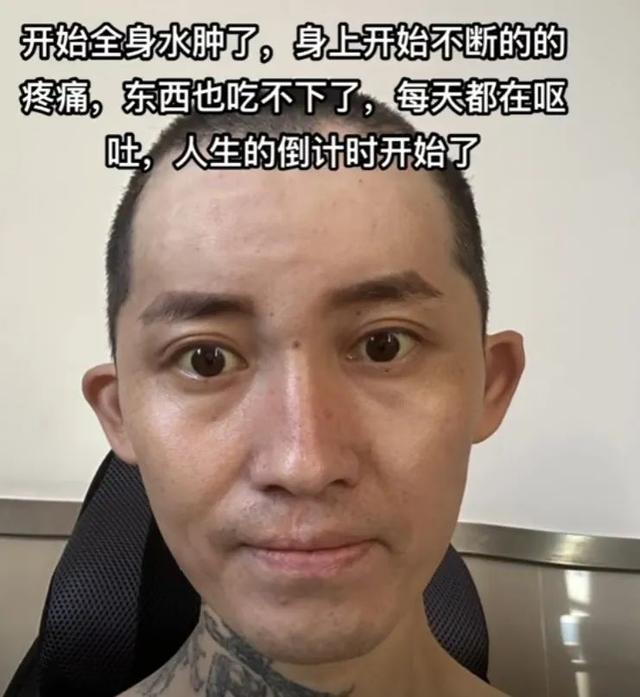 29岁抗癌网红大飞去世 最后一条视频充满生之渴望