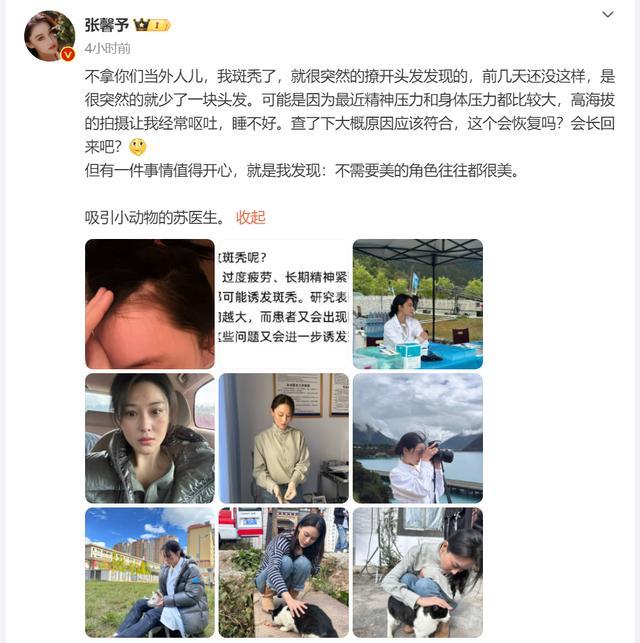 张馨予自曝患斑秃 高海拔拍摄压力大