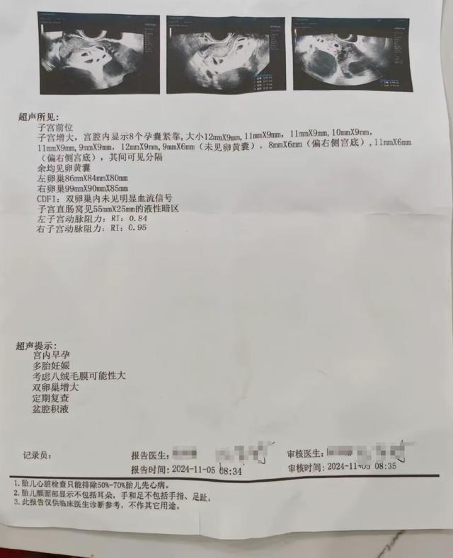 怀9胞胎女子完成减胎:还有2胎,在医院调养保胎中 愿孩子健康出生