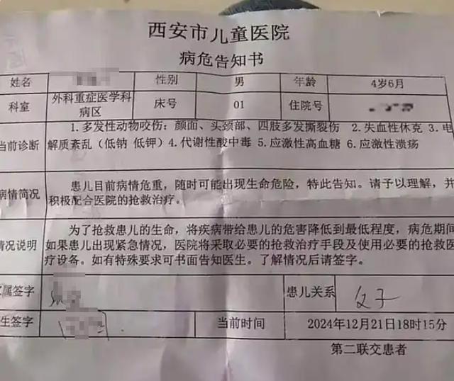 律师谈西安4岁男童遭犬撕咬 饲养者法律责任解析