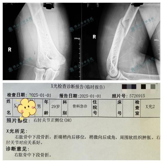 两小伙与机器人掰手腕当场骨折 游乐设施力量惊人