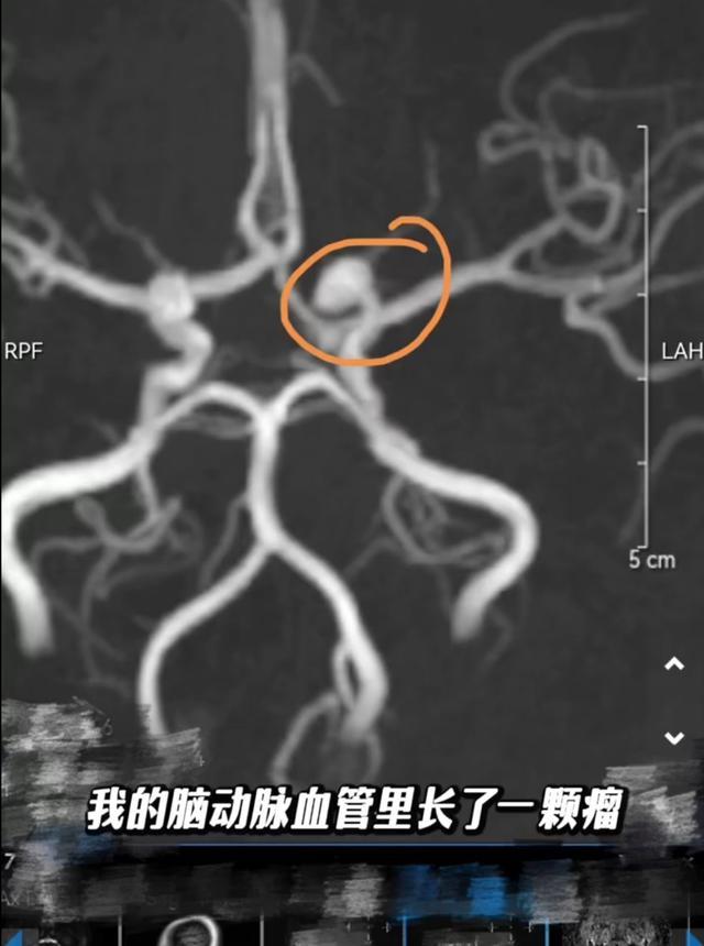 31歲演員孫銥自曝二胎生化 提醒寶媽重視檢查