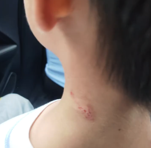 弟弟朝小猴子竖中指被一群猴打了 网友：家里没人教出门被猿辅导教-男子在四川四姑娘
