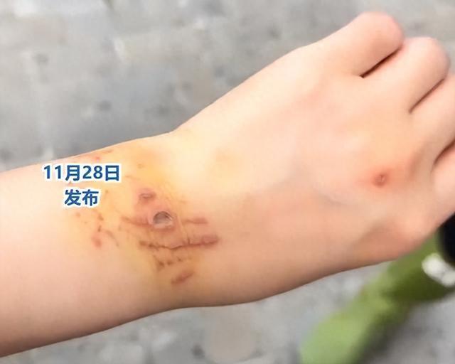 该女子回答说，她在月经期间潜水时被鲨鱼咬伤