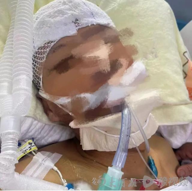 脑梗老人因过度医疗去世 医院过错引争议