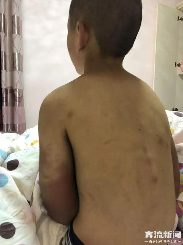 14岁少年遭生父继母长期虐待离世 呼唤正义与严惩