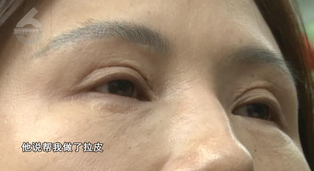 4万整形还不如术前 院方回应 顾客不满效果要求赔偿