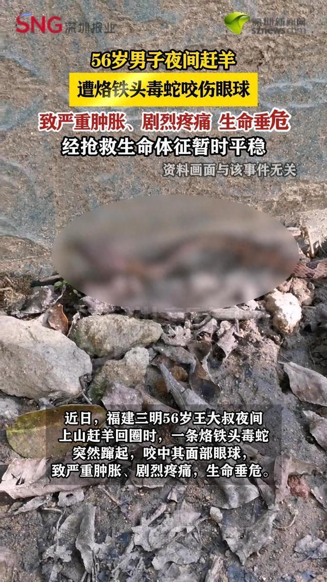 男子赶羊遭毒蛇咬伤后被送进ICU