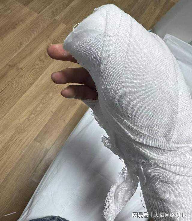 客服回应刀具裸装割伤医学生手神经