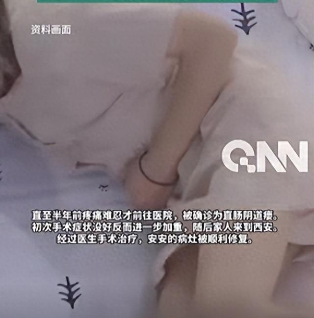 女孩下体漏便确诊直肠阴道瘘