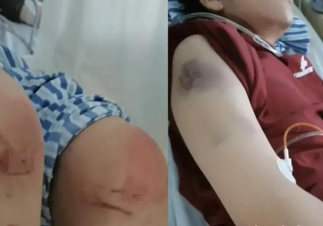 女子遭家暴逃跑致丈夫身亡二审判决 逃命何罪之有？
