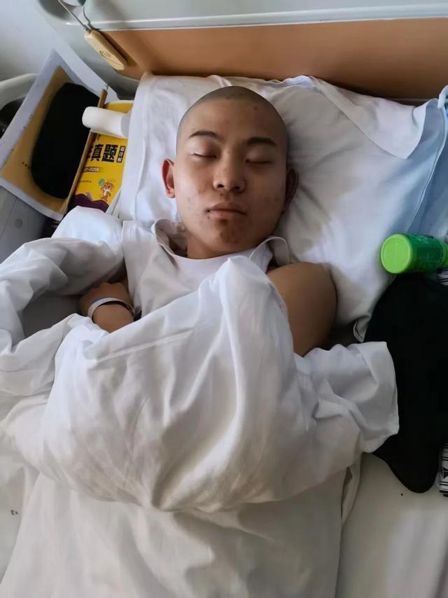 山东少年查出骨肉瘤仍然坚持高考 病痛中的坚韧与希望