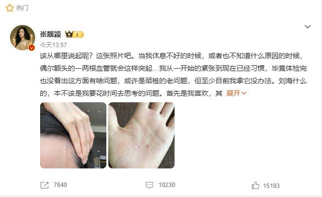 张靓颖自曝患病 伸懒腰手掌流血十年