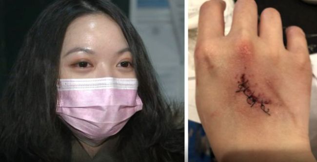华裔女学生在美受伤：夜间被尾随锁喉 危急时刻一举动吓跑嫌犯 