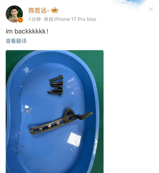 陈哲远手术取钢钉后首亮相