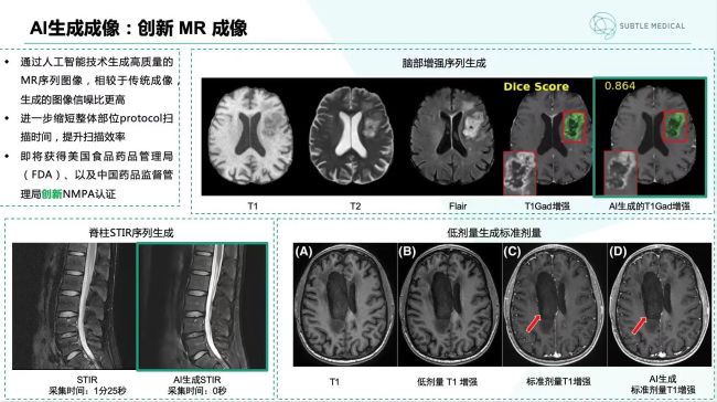 SubtleGAD、SubtleSynth等多个新产品通过临床多中心研究证明了其算法准确性与高效性