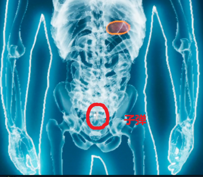 《检疫区：最后一站》皮下之物成就攻略分享