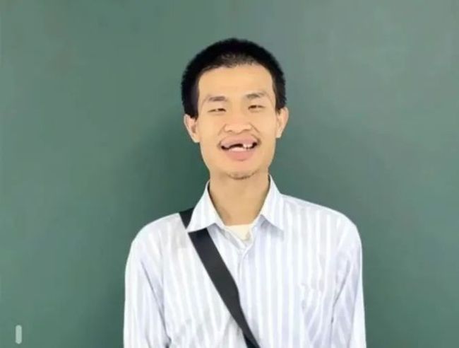 北大“韦神”患上这种牙病！从偶尔刷牙出血，到牙齿掉光仅有三步！