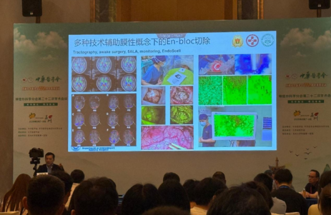 中华医学会神经外科学分会第二十二次学术会议在苏召开：细胞级荧光导引技术引领神经外科手术迈入"精准可视化"新时代