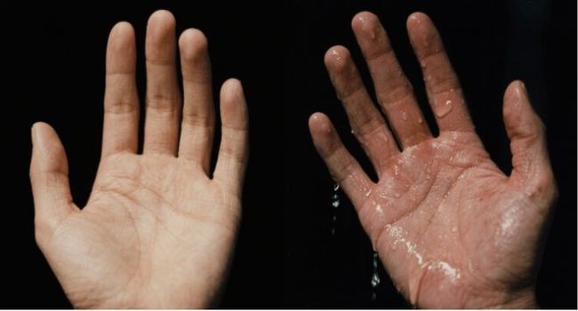 ˫�ֳ��ꡰʪ����������ֻ���ǡ������������������ֺ�֢������