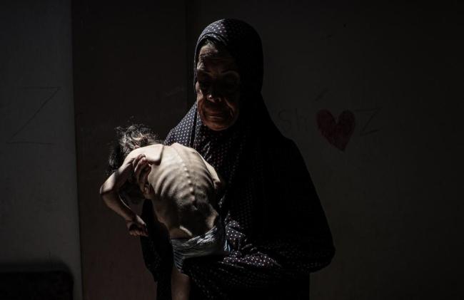 加沙的生死挣扎 儿童饥饿干渴日益恶化 