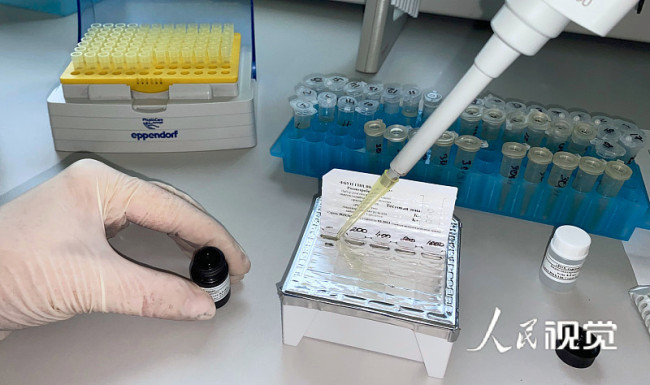 当地时间2022年5月18日，俄罗斯新西伯利亚，猴痘检测试剂盒。