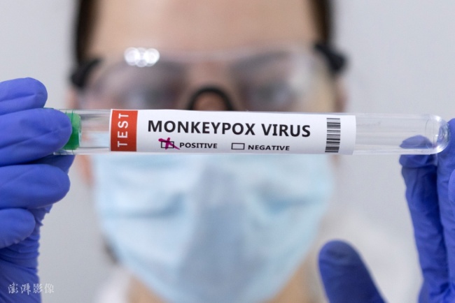 英国发现猴痘病毒新毒株 患者近期去过非洲
