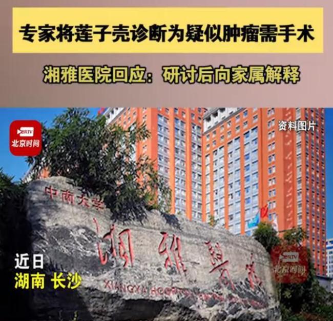 湘雅医院专家将莲子壳诊断为肿瘤 院方回应