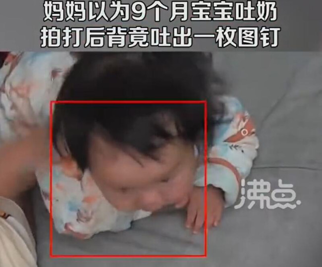 细思极恐！妈妈以为宝宝吐奶拍背后吐出图钉 宝宝目前情况稳定